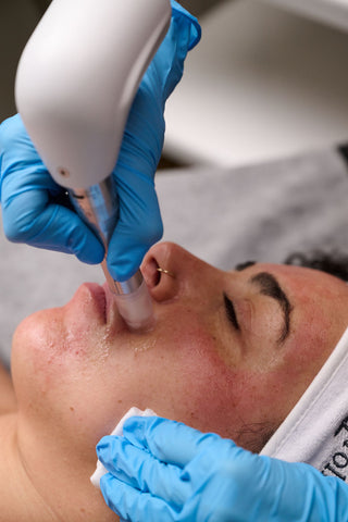 Micro-Aiguillage Visage