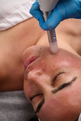 Micro-Aiguillage Visage